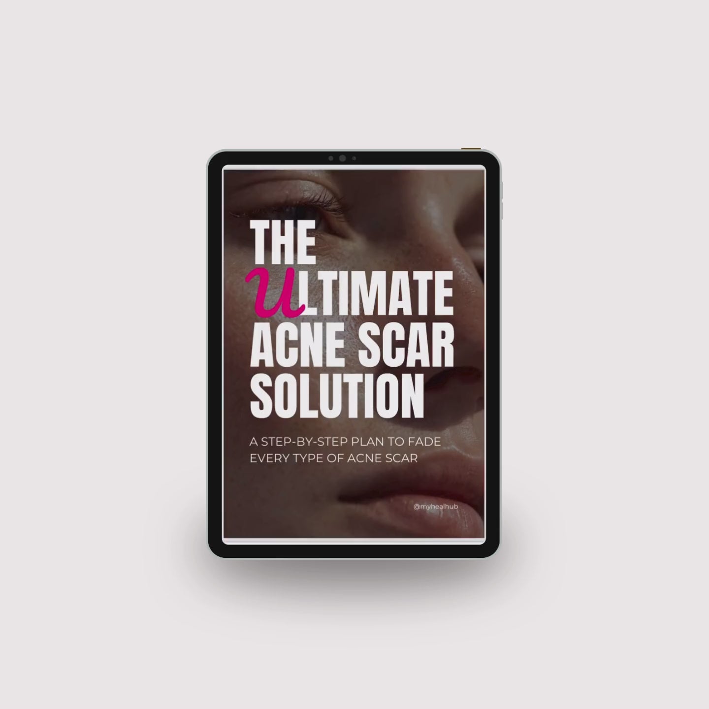 The Ultimate Acne Scar Solution